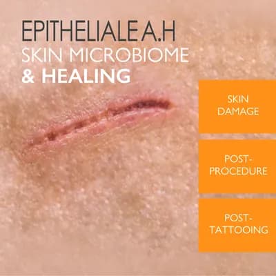 A-Derma Epitheliale Ultra Cream (1+1), 40 ml