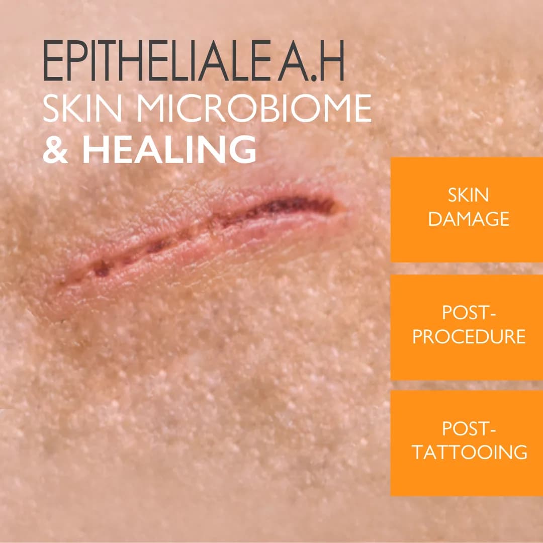 A-Derma Epitheliale Ultra Cream (1+1), 40 ml