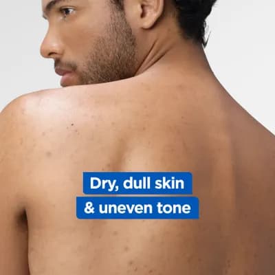 Mixa Niacinamide Lotion 250 ml