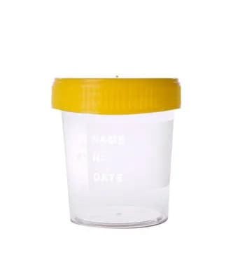 Urine Cup 100ml Plastic