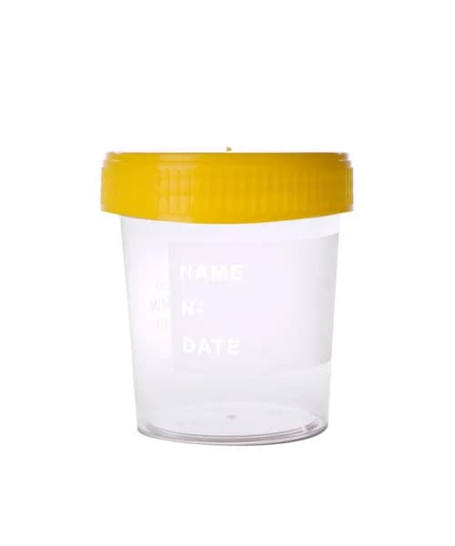 Urine Cup 100ml Plastic